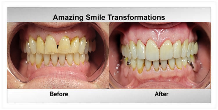 Before and after dental treatment